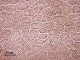 5 - Cellule corticali subapicali in visione superficiale